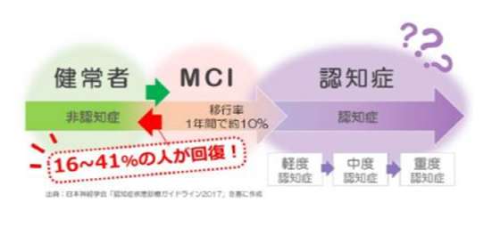 MCIの状態を説明した画像