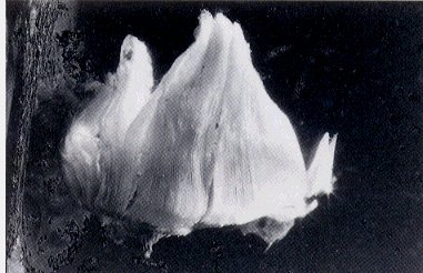 クモの書肺の写真